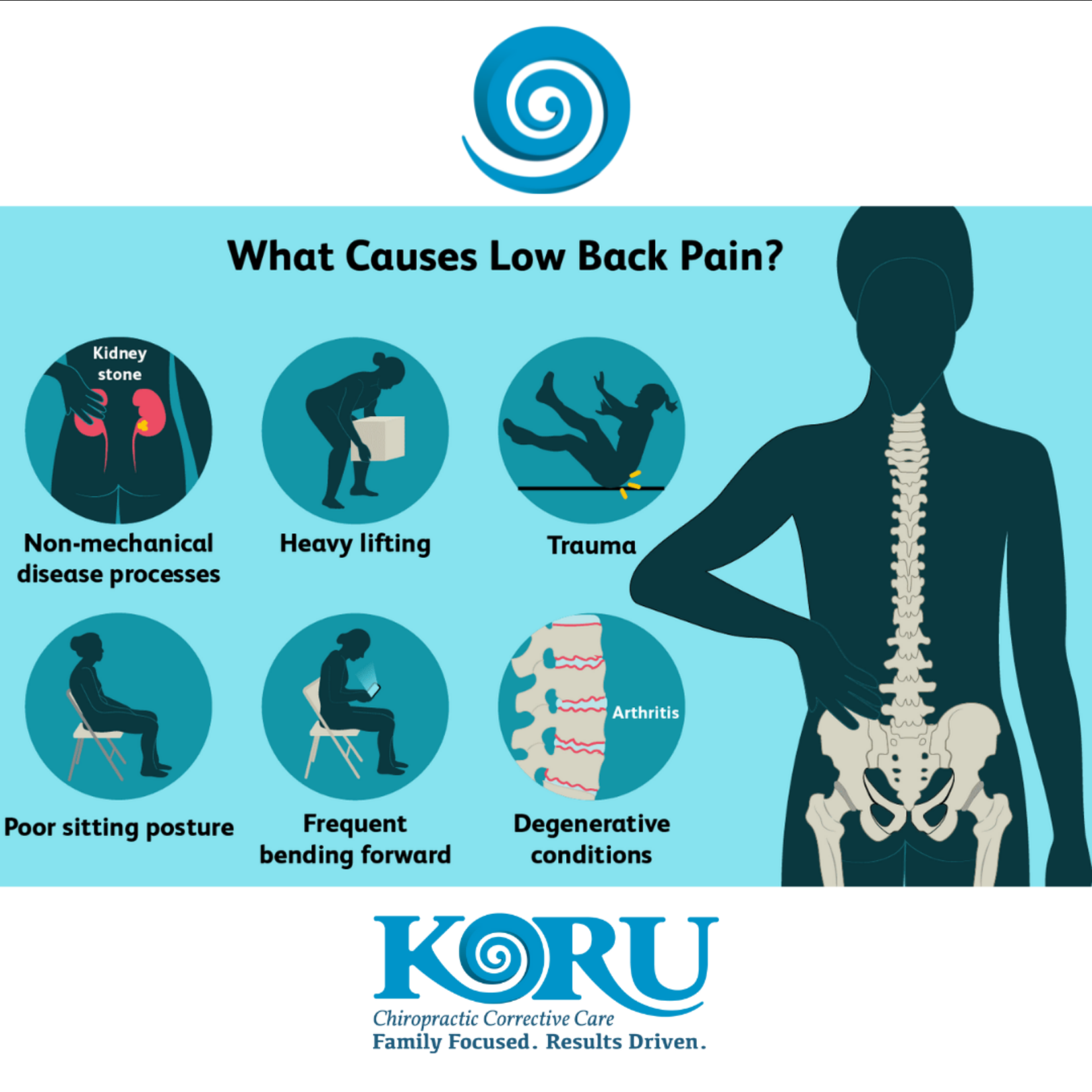 Causes of low back pain 