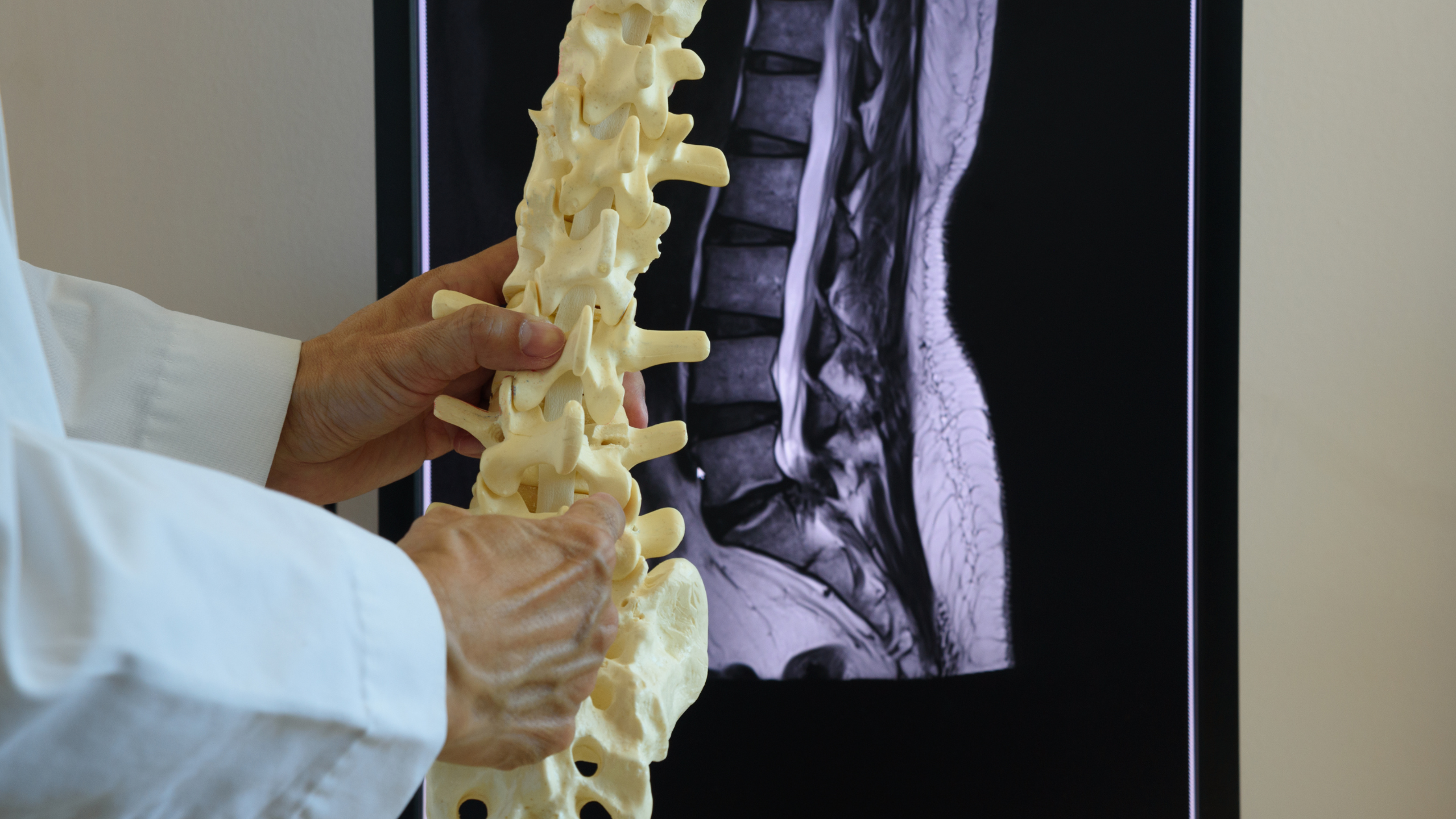 spinal subluxation