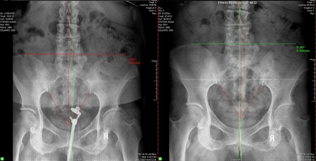 x-ray change