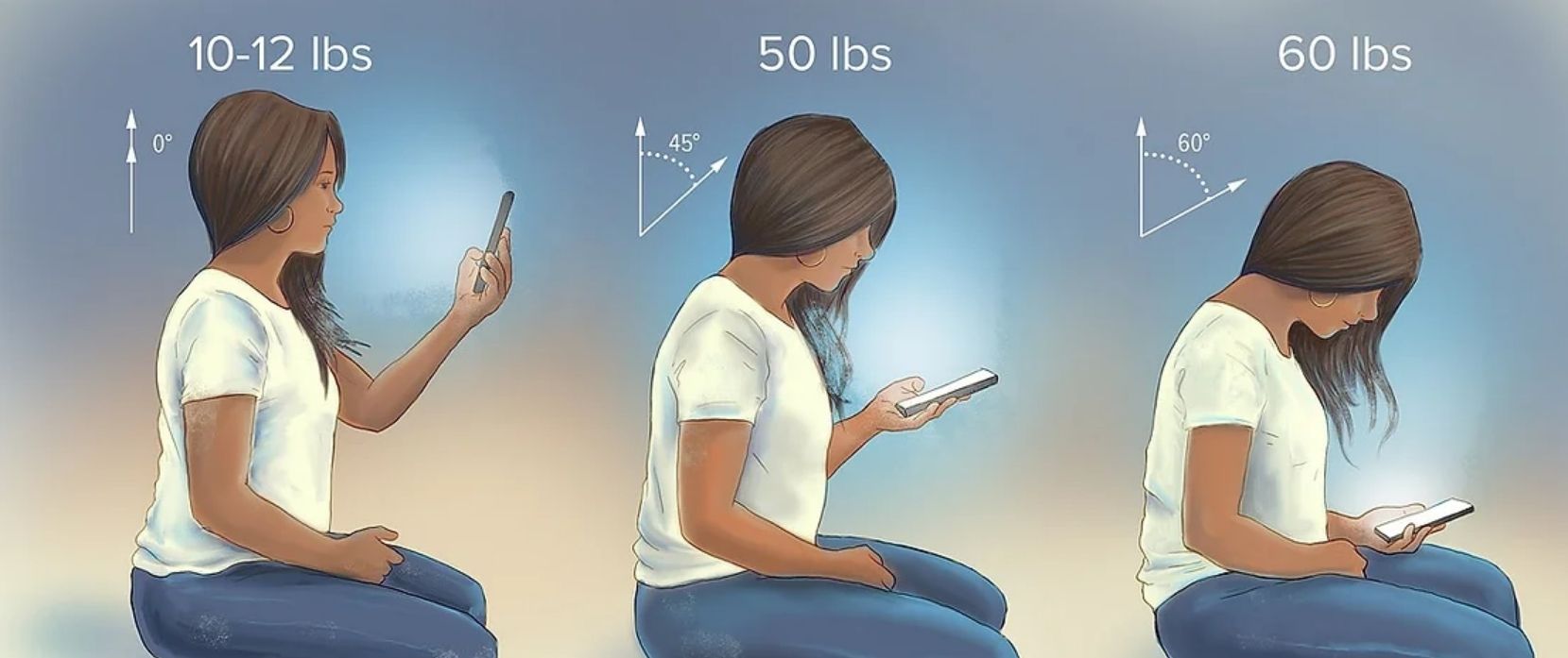 forward head posture or text-neck