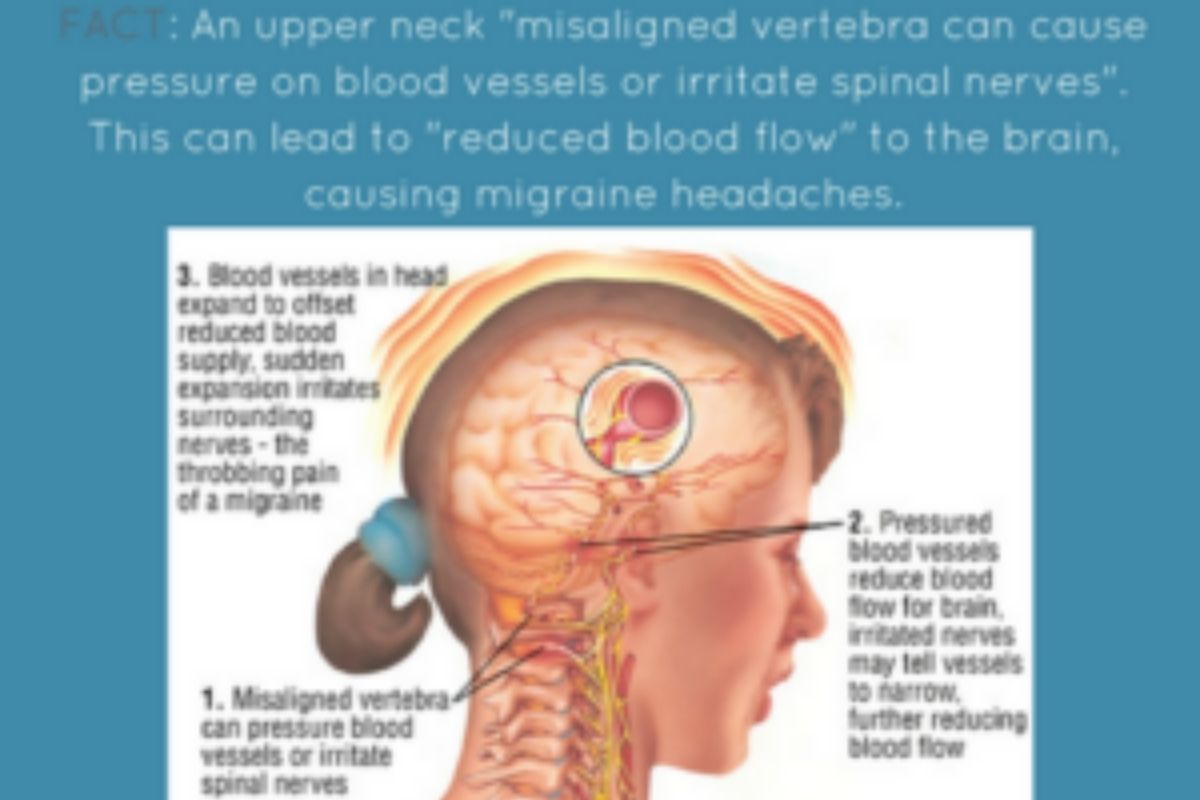Upper cervical misalignment