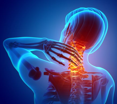 depiction of upper cervical misalignment pain