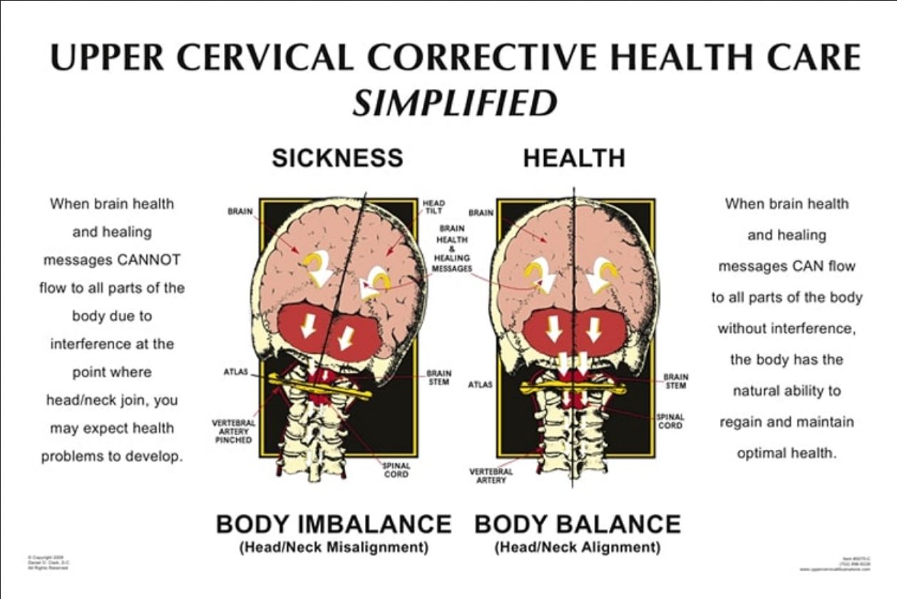 the effects of a cervical misalignment