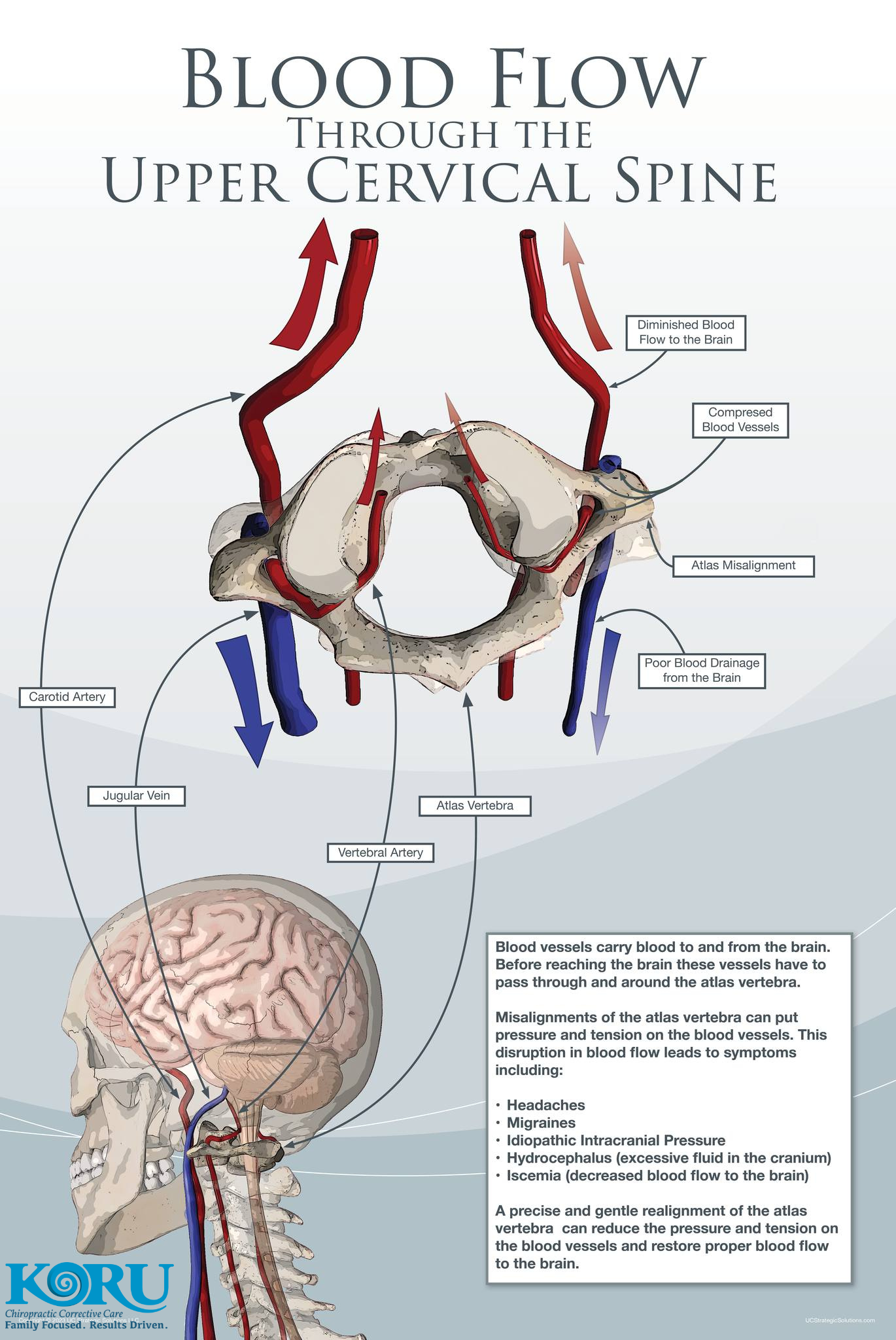 blood flow in the upper cervical spine 